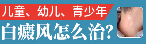 湖州治疗白癜风医院