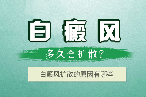 杭州白癜风怎么治 白癜风扩散的原因是什么呢?